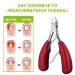 Podiatry Toe Nail Clippers for Thick/Heavy Duty Nails - Image 6